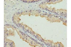 Immunohistochemistry (IHC) image for anti-High Mobility Group Box 1 (HMGB1) (AA 8-179) antibody (ABIN7155205)