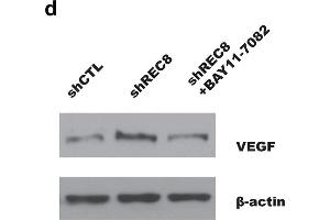 NF-κB is required for VEGF transcription in gastric cancer cell with ablation of REC8.