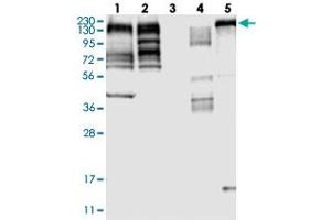 Western blot analysis of Lane 1: RT-4, Lane 2: U-251 MG, Lane 3: Human Plasma, Lane 4: Liver, Lane 5: Tonsil with MLLT4 polyclonal antibody  at 1:250-1:500 dilution. (Afadin antibody)