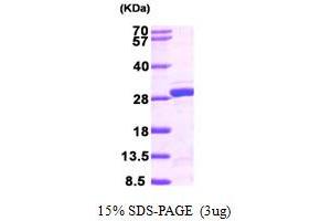 SDS-PAGE (SDS) image for Nudix (Nucleoside Diphosphate Linked Moiety X)-Type Motif 21 (NUDT21) (AA 1-227) protein (His tag) (ABIN667366)