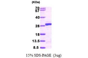 SDS-PAGE (SDS) image for Nudix (Nucleoside Diphosphate Linked Moiety X)-Type Motif 21 (NUDT21) (AA 1-227) protein (His tag) (ABIN667366) (NUDT21 Protein (AA 1-227) (His tag))