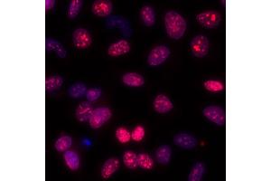 Immunofluorescence (IF) image for anti-Antigen Identified By Monoclonal Antibody Ki-67 (MKI67) (AA 1200-1250) antibody (ABIN7449552) (Recombinant Ki-67 antibody  (AA 1200-1250))