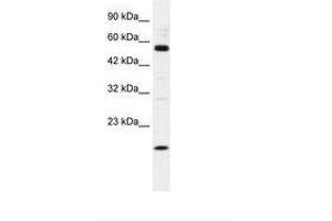 Image no. 1 for anti-Zinc Finger Protein 436 (ZNF436) (AA 104-153) antibody (ABIN202607) (ZNF436 antibody  (AA 104-153))