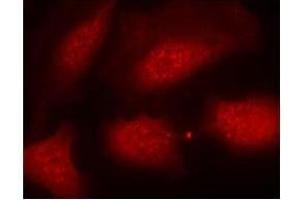 Image no. 3 for anti-Histone H3.1 (HIST1H3B) (pSer10) antibody (ABIN196922) (Histone H3.1 antibody  (pSer10))