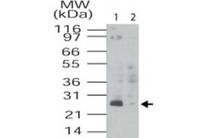 Western blot analysis of TMED4 in HL-60 cell lysates. (TMED4 antibody  (AA 55-67))