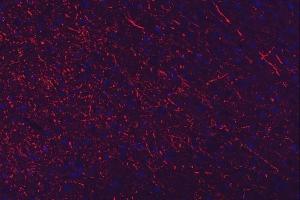 IF analysis of NEFL/NF-L using anti-NEFL/NF-L antibody (ABIN7601626).