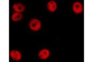 ABIN6276640 staining Hela cells by IF/ICC. (ERG antibody  (C-Term))