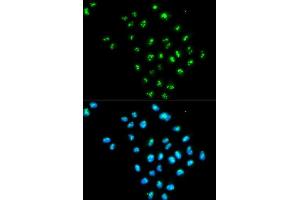 Immunofluorescence analysis of MCF-7 cells using EIF6 antibody. (EIF6 antibody  (AA 1-245))