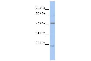 FAM98B antibody used at 1 ug/ml to detect target protein. (FAM98B antibody  (N-Term))