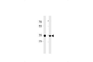 RPLP0P6 Antibody (N-term) (ABIN1881762 and ABIN2843386) western blot analysis in ,PC-3 cell line lysates (35 μg/lane). (RPLP0P6 antibody  (N-Term))