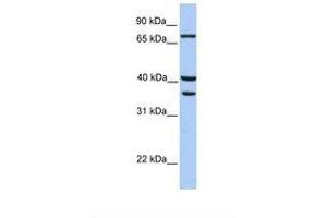 Image no. 1 for anti-Transglutaminase 5 (TGM5) (C-Term) antibody (ABIN6738541) (Transglutaminase 5 antibody  (C-Term))