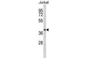 Western blot analysis of CCR3 Antibody (Center) in Jurkat cell line lysates (35ug/lane). (CCR3 antibody  (Middle Region))