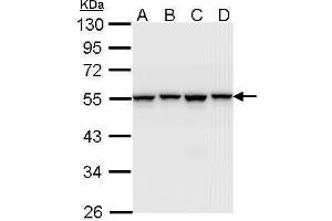 WB Image Sample (30 ug of whole cell lysate) A: A431 , B: H1299 C: Hela D: Hep G2 , 10% SDS PAGE antibody diluted at 1:1000 (HNRNPH1 antibody)