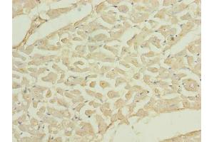 Immunohistochemistry of paraffin-embedded human heart tissue using ABIN7173395 at dilution of 1:100