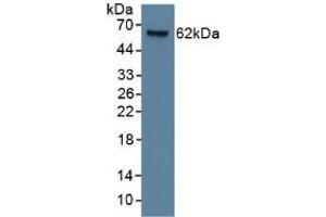 Figure. (KRT9 antibody  (AA 315-456))