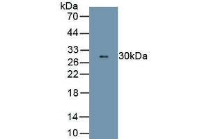 Detection of Recombinant ELA2, Rat using Polyclonal Antibody to Neutrophil Elastase (NE) (ELANE antibody  (AA 31-271))