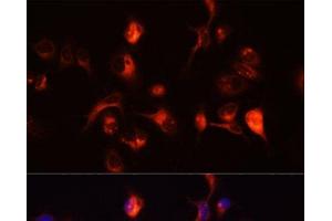Immunofluorescence analysis of A431 cells using TOR1A Polyclonal Antibody at dilution of 1:100 (40x lens). (TOR1A antibody)