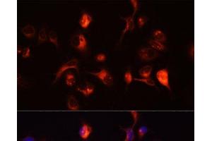 Immunofluorescence analysis of A431 cells using TOR1A Polyclonal Antibody at dilution of 1:100 (40x lens).
