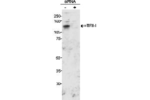Western Blotting (WB) image for anti-General Transcription Factor III (GTF2I) (C-Term) antibody (ABIN7449365) (GTF2I antibody  (C-Term))