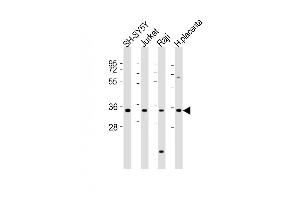 All lanes : Anti-RASSF2 Antibody (Center) at 1:2000 dilution Lane 1: SH-SY5Y whole cell lysates Lane 2: Jurkat whole cell lysates Lane 3: Raji whole cell lysates Lane 4: human placenta lysates Lysates/proteins at 20 μg per lane. (RASSF2 antibody  (AA 123-156))