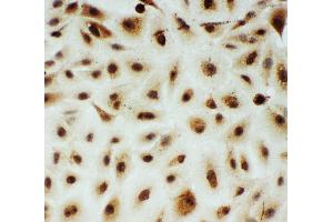 Immunohistochemistry (IHC) image for anti-V-Myb Myeloblastosis Viral Oncogene Homolog (Avian)-Like 2 (MYBL2) (AA 1-17), (N-Term) antibody (ABIN3044010)