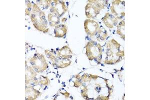 Immunohistochemistry of paraffin-embedded human stomach using RBP2 antibody.