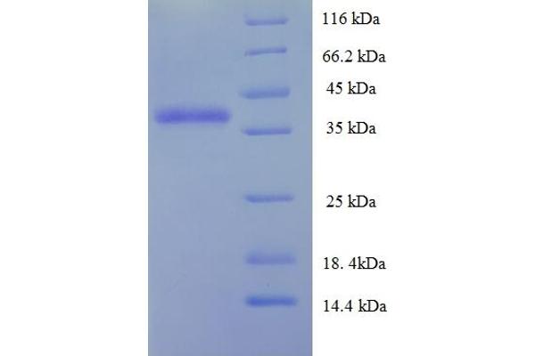 DGCR6L Protein (AA 1-220, full length) (His-SUMO Tag)