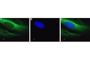 Immunocytochemistry (ICC) image for anti-Calcium Channel, Voltage-Dependent, L Type, alpha 1C Subunit (CACNA1C) (AA 848-865), (Intracellular) antibody (Atto 488) (ABIN7042998)