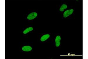 Immunofluorescence of purified MaxPab antibody to SMARCA5 on HeLa cell. (SMARCA5 antibody  (AA 1-1052))