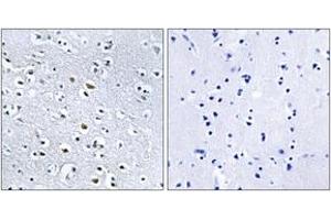 Immunohistochemistry analysis of paraffin-embedded human brain, using NPHP4 Antibody. (NPHP4 antibody  (AA 877-926))