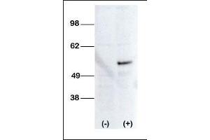 Western blot analysis of anti-STK38L Pab (ABIN392120 and ABIN2841867) transiently transfected HEK-293 cell line lysate (1 μg/lane).