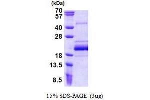 SDS-PAGE (SDS) image for BUD31 Homolog (BUD31) (AA 1-144) protein (His tag) (ABIN6387209)