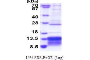 Musculoskeletal, Embryonic Nuclear Protein 1 (MUSTN1) (AA 1-82) protein (His tag)