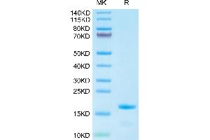 IL-3 Protein (AA 20-143) (His tag)