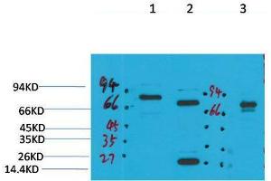 Western Blot (WB) analysis of 1) Rat Brain Tissue, 2)Mouse Brain Tissue, 3) HepG2 with KCNN2(SK2) Rabbit Polyclonal Antibody diluted at 1:2000. (KCNN2 antibody)