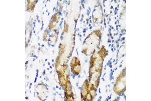 Immunohistochemistry of paraffin-embedded human gastric using NAA60 antibody (ABIN5975517) at dilution of 1/200 (40x lens). (NAT15 antibody)