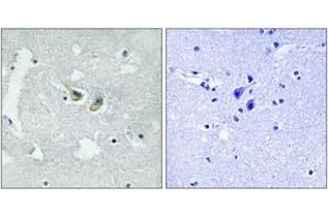 Immunohistochemistry analysis of paraffin-embedded human brain, using p47 phox (Phospho-Ser345) Antibody.