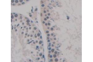 Used in DAB staining on fromalin fixed paraffin- embedded Kidney tissue (NEK2 antibody  (AA 125-393))