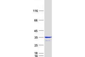 MITD1 Protein (Myc-DYKDDDDK Tag)