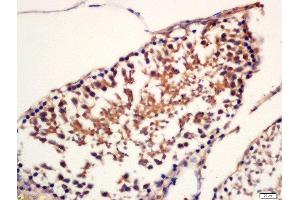 Formalin-fixed and paraffin embedded rat testis labeled with Rabbit Anti-SPAG16 Polyclonal Antibody, Unconjugated (ABIN1387439) at 1:200 followed by conjugation to the secondary antibody and DAB staining (SPAG16 antibody  (AA 439-485))