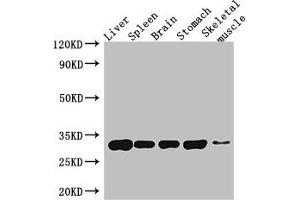 Western Blot Positive WB detected in: Mouse liver tissue, Mouse spleen tissue, Mouse brain tissue, Mouse stomach tissue, Mouse skeletal muscle tissue All lanes: GPM6A antibody at 4 μg/mL Secondary Goat polyclonal to rabbit IgG at 1/50000 dilution Predicted band size: 32, 31, 30 kDa Observed band size: 32 kDa (GPM6A antibody  (AA 149-213))