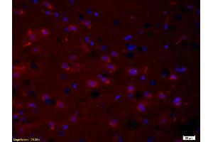 Formalin-fixed and paraffin embedded rat brain tissue labeled with Anti- phospho-PRKC Polyclonal Antibody, Unconjugated (ABIN741240) at 1:200 followed by conjugation to the secondary antibody Goat Anti-Rabbit IgG, PE conjugated used at 1:200 dilution for 40 minutes at 37°C and DAPI (PKC beta antibody  (pThr500))