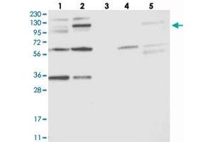 Western blot analysis of Lane 1: RT-4, Lane 2: U-251 MG, Lane 3: Human Plasma, Lane 4: Liver, Lane 5: Tonsil with OSBP2 polyclonal antibody .