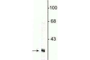 Western blot of HeLa cell lysate showing specific immunolabeling of the ~34 kDa fibrillarin protein.