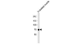 Anti-GABRQ Antibody (C-term) at 1:1000 dilution + human skeletal muscle lysates Lysates/proteins at 20 μg per lane. (GABRQ antibody  (AA 451-485))