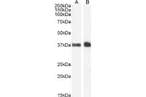 ABIN185486 (1 μg/mL) staining of Human Peripheral Blood Monocytes (A) and Kidney (B) lysate (35 μg protein in RIPA buffer). (CD235a/GYPA antibody  (C-Term))