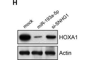 SNHG1 acts as a sponge of miR-193a-5p to activate HOXA1 expression. (HOXA1 antibody  (AA 75-205))