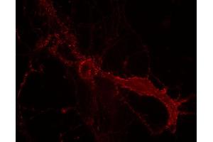 Indirect immunostaining of PFA fixed rat hippocampus neurons (dilution 1 : 100). (DLG3 antibody)