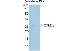Western blot analysis of the recombinant protein. (SP100 antibody  (AA 261-465))
