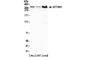 Western Blotting (WB) image for anti-Spectrin Beta, Non-Erythrocytic 1 (SPTBN1) (AA 2100-2150) antibody (ABIN7454694)